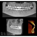     Rayscan α+ 3D 160x100 Ceph